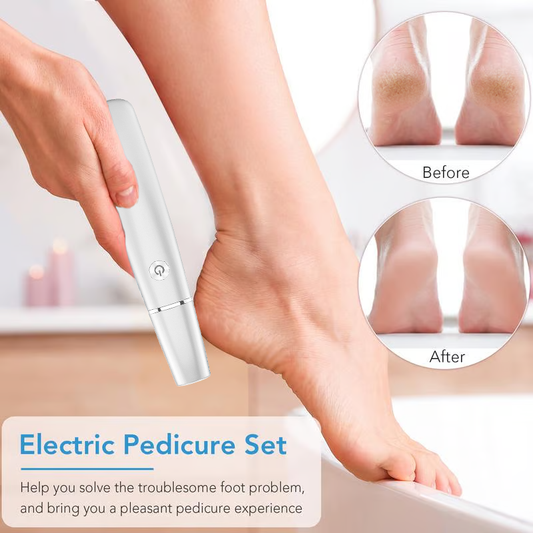 🔥last day sale 50% off🔥Electric callus remover for fee